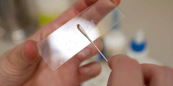 Hautabkratzung auf Parasiten